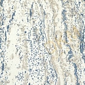 Alternative view of Decowall Tudor 3511-01 Döküntülü sıva Duvar Kağıdı 16m²